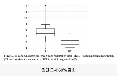 진단 오차 60% 감소